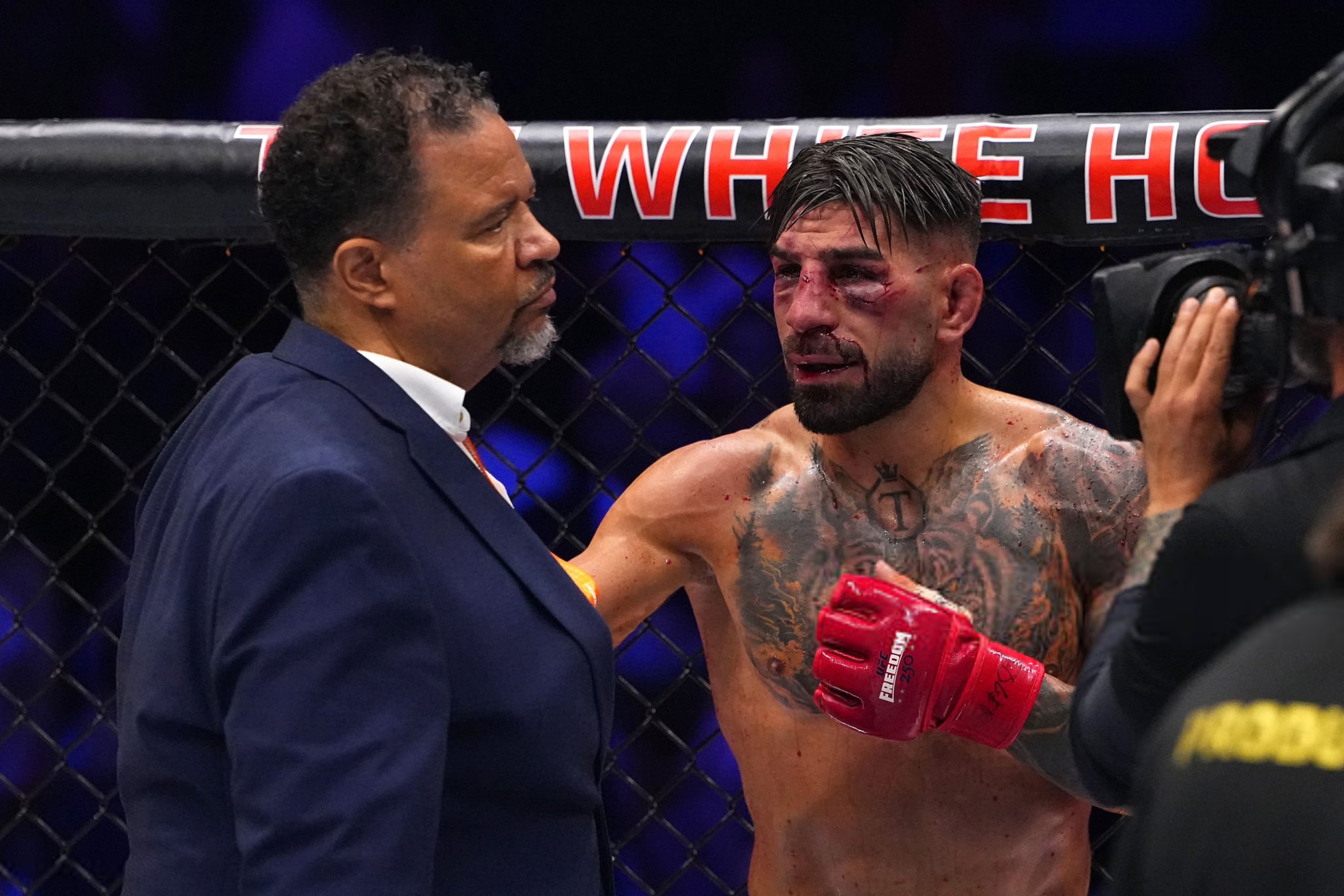Боец UFC Илия Топурия получил перелом глазницы в жестком противостоянии с Гэтжи